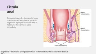 Fistula
anal
Conducto de paredes ﬁbrosas infectadas
que comunica a la cripta anal que le dio
origen con la piel perianal o con el recto.
Posee un oriﬁcio primario y otro
secundario.
Diagnóstico y tratamiento quirúrgico de la fístula anal en el adulto; México. Secretaria de Salud;
 