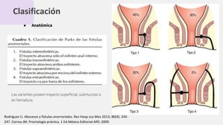 Clasificación
Las variantes poseen trayecto superﬁcial, submucoso o
en herradura.
● Anatómica
Rodríguez U. Abscesos y fístulas anorrectales. Rev Hosp Jua Mex 2013; 80(4): 243-
247. Correa JM. Proctología práctica. 1 Ed.México.Editorial Alfil; 2009.
 