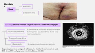 Diagnóstic
o
Clínica
Anamnesis
Exploración física
Ultrasonido endoanal
Resonancia magnética
Manometría
Para mejor identiﬁcación del trayecto ﬁstuloso o en fístulas complejas.
Se puede inyectar en el oriﬁcio secundario peróxido
de hidrógeno o azul de metileno diluido para
mejorar visualización.
En pacientes con incontinencia previa
Diagnóstico y tratamiento quirúrgico de la fístula anal en el adulto; México. Secretaria de Salud;
2013. Correa JM. Proctología práctica. 1 Ed.México.Editorial Alfil; 2009.
 