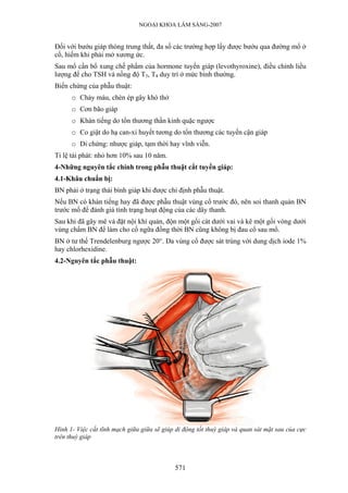 NGOẠI KHOA LÂM SÀNG-2007


Đối với bướu giáp thòng trung thất, đa số các trường hợp lấy được bướu qua đường mổ ở
cổ, hiếm khi phải mở xương ức.
Sau mổ cần bổ xung chế phẩm của hormone tuyến giáp (levothyroxine), điều chỉnh liều
lượng để cho TSH và nồng độ T3, T4 duy trì ở mức bình thường.
Biến chứng của phẫu thuật:
      o Chảy máu, chèn ép gây khó thở
      o Cơn bão giáp
      o Khàn tiếng do tổn thương thần kinh quặc ngược
      o Co giật do hạ can-xi huyết tương do tổn thương các tuyến cận giáp
      o Di chứng: nhược giáp, tạm thời hay vĩnh viễn.
Tỉ lệ tái phát: nhỏ hơn 10% sau 10 năm.
4-Những nguyên tắc chính trong phẫu thuật cắt tuyến giáp:
4.1-Khâu chuẩn bị:
BN phải ở trạng thái bình giáp khi được chỉ định phẫu thuật.
Nếu BN có khàn tiếng hay đã được phẫu thuật vùng cổ trước đó, nên soi thanh quản BN
trước mổ để đánh giá tình trạng hoạt động của các dây thanh.
Sau khi đã gây mê và đặt nội khí quản, độn một gối cát dưới vai và kê một gối vòng dưới
vùng chẩm BN để làm cho cổ ngữa đồng thời BN cũng không bị đau cổ sau mổ.
BN ở tư thế Trendelenburg ngược 20°. Da vùng cổ được sát trùng với dung dịch iode 1%
hay chlorhexidine.
4.2-Nguyên tắc phẫu thuật:




Hình 1- Việc cắt tĩnh mạch giữa giữa sẽ giúp di động tốt thuỳ giáp và quan sát mặt sau của cực
trên thuỳ giáp



                                             571
 