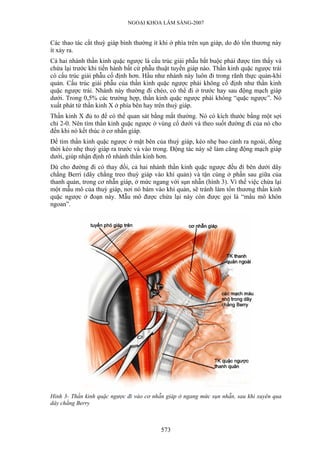 NGOẠI KHOA LÂM SÀNG-2007


Các thao tác cắt thuỳ giáp bình thường ít khi ở phía trên sụn giáp, do đó tổn thương này
ít xảy ra.
Cả hai nhánh thần kinh quặc ngược là cấu trúc giải phẫu bắt buộc phải được tìm thấy và
chừa lại trước khi tiến hành bất cứ phẫu thuật tuyến giáp nào. Thần kinh quặc ngược trái
có cấu trúc giải phẫu cố định hơn. Hầu như nhánh này luôn đi trong rãnh thực quản-khí
quản. Cấu trúc giải phẫu của thần kinh quặc ngược phải không cố định như thần kinh
quặc ngược trái. Nhánh này thường đi chéo, có thể đi ở trước hay sau động mạch giáp
dưới. Trong 0,5% các trường hợp, thần kinh quặc ngược phải không “quặc ngược”. Nó
xuất phát từ thần kinh X ở phía bên hay trên thuỳ giáp.
Thần kinh X đủ to để có thể quan sát bằng mắt thường. Nó có kích thước bằng một sợi
chỉ 2-0. Nên tìm thần kinh quặc ngược ở vùng cổ dưới và theo suốt đường đi của nó cho
đến khi nó kết thúc ở cơ nhẫn giáp.
Để tìm thần kinh quặc ngược ở mặt bên của thuỳ giáp, kéo nhẹ bao cảnh ra ngoài, đồng
thời kéo nhẹ thuỳ giáp ra trước và vào trong. Động tác này sẽ làm căng động mạch giáp
dưới, giúp nhận định rõ nhánh thần kinh hơn.
Dù cho đường đi có thay đổi, cả hai nhánh thần kinh quặc ngược đều đi bên dưới dây
chằng Berri (dây chằng treo thuỳ giáp vào khí quản) và tận cùng ở phần sau giữa của
thanh quản, trong cơ nhẫn giáp, ở mức ngang với sụn nhẫn (hình 3). Vì thế việc chừa lại
một mẫu mô của thuỳ giáp, nơi nó bám vào khí quản, sẽ tránh làm tổn thương thần kinh
quặc ngược ở đoạn này. Mẫu mô được chừa lại này còn được gọi là “mẩu mô khôn
ngoan”.




Hình 3- Thần kinh quặc ngược đi vào cơ nhẫn giáp ở ngang mức sụn nhẫn, sau khi xuyên qua
dây chằng Berry



                                          573
 