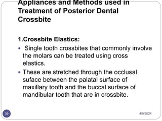 430015924-Management-of-Crossbi. te.pptx