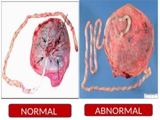 ABNORMAL
NORMAL
 
