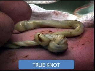 TRUE KNOT
 