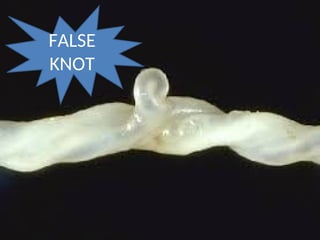 FALSE
KNOT
 