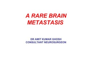 A RARE BRAIN
METASTASIS
DR AMIT KUMAR GHOSH
CONSULTANT NEUROSURGEON
 