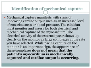 Identification of mechanical capture
 Mechanical capture manifests with signs of
improving cardiac output such as an increased level
of consciousness or blood pressure. The clinician
must monitor and assess for both electrical and
mechanical capture of the myocardium. The
electrical activity of the external pacer shows up
clearly on the monitor as large complexes at the rate
you have selected. While pacing capture on the
monitor is an important sign, the appearance of
these complexes does not mean that the
patient’s myocardium is mechanically
captured and cardiac output is occurring.
 