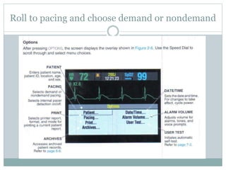 Roll to pacing and choose demand or nondemand
 