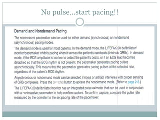 No pulse…start pacing!!
 