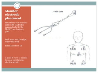 Monitor
electrode
placement
Place three wire monitor
cable with electrodes
perpendicular to the
Medi-Trace Cadence
pads.
Both arms and the right
side works well.
Select lead II or III
A good R wave is needed
to sense spontaneous
electical activity.
 