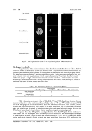  ISSN: 2088-8708
Int J Elec & Comp Eng, Vol. 9, No. 3, June 2019 : 1832 - 1841
1838
Type of Stroke DWI Image Manual Reference Segmentation Result
Acute Ischemic
Chronic Ischemic
Acute Hemorrhage
Sub-acute Ischemic
Figure 2. The segmentation results of the original image from DWI stroke lesion
3.2. Bagged tree classifier
The performance of the confusion matrices of the classification method is shown in Table 3. Table 3
shows the number of observations of each type of stroke lesion. Only all chronic ischemic stroke samples are
correctly classified into its group.5 sample of acute ischemic is misclassified into sub-acute ischemic lesion.
For acute hemorrhage stroke only 3 sample areclassified correctly. 4 other sample are misclassified into sub-
acute ischemic others into acute ischemic. For sub-acute ischemic stroke 67 sample is classified correctly
within their groups, 1 sample is misclassified into acute ischemic and others 1 is misclassified into acute
hemorrhage. The hyperintense lesion is mostly misclassified into their classes due to the range of features of
each class that shares the same features with other class.
Table 3. The Performance Metric for Classification Method
Predicted Class
Acute Hemorrhage Acute Ischemic Chronic Ischemic Sub-acute Ischemic
True Class
Acute Hemorrhage 3 1 4
Acute Ischemic 15 5
Chronic Ischemic 33
Sub-acute Ischemic 1 1 67
Table 4 shows the performance value of TPR, FNR, PPV and FDR of each type of stroke. Chronic
ischemic stroke shows better performance base on higher value in TPR and PPV with lower value of FNR
and FDR. The proposed classification method shows the performance result for acute ischemic, chronic
ischemic and sub-acute ischemic is high compare to the acute hemorrhage. The TPR result for acute stroke
show low value because the sample of acute hemorrhage refer to sub-acute ischemic is higher. However, the
PPV of acute hemorrhage is close to 1 since that the acute hemorrhage is correctly diagnosed.
Figure 3 shows the ROC plot for each type of stroke. From the ROC plot, chronic stroke shows
100% on the TPR axis showing the stroke is correctly classified into its class. The positive type of each type
of stroke for acute ischemic, chronic ischemic and acute hemorrhage is 2%, 1% and 15 % respectively. Based
on the result, acute ischemic, chronic ischemic and acute hemorrhage shows good ROC results since the
 
