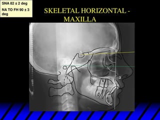 432371195 lateral cephalo metry anlysis .pdf