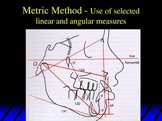 432371195 lateral cephalo metry anlysis .pdf