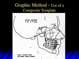 432371195 lateral cephalo metry anlysis .pdf