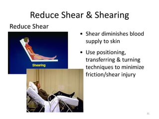 Sheering Injuries 4332287.ppt
