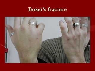 435119306-Anatomy-and-Injuries-to-the-Wrist-and-Hand.pptx