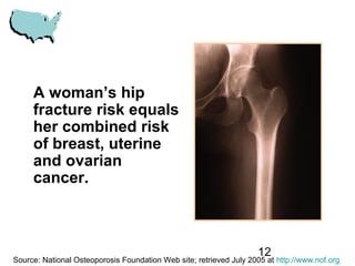 12
A woman’s hip
fracture risk equals
her combined risk
of breast, uterine
and ovarian
cancer.
Source: National Osteoporosis Foundation Web site; retrieved July 2005 at http://www.nof.org
 
