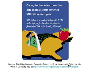 15
Source: The 2004 Surgeon General’s Report on Bone Health and Osteoporosis:
What It Means to You at http://www.surgeongeneral.gov/library/bonehealth
 
