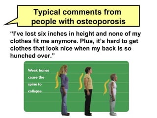 4
“I’ve lost six inches in height and none of my
clothes fit me anymore. Plus, it’s hard to get
clothes that look nice when my back is so
hunched over.”
Typical comments from
people with osteoporosis
 