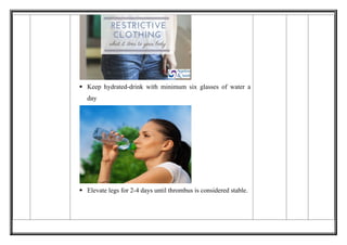 Comprehensive Lesson Plan on Prevention of Deep Vein Thrombosis for ...