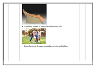 Comprehensive Lesson Plan on Prevention of Deep Vein Thrombosis for ...