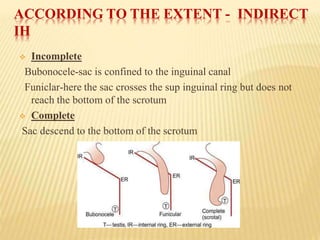 ACCORDING TO THE EXTENT - INDIRECT
IH
 Incomplete
Bubonocele-sac is confined to the inguinal canal
Funiclar-here the sac crosses the sup inguinal ring but does not
reach the bottom of the scrotum
 Complete
Sac descend to the bottom of the scrotum
 