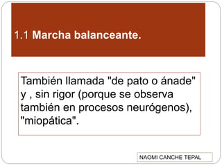 1.1 Marcha balanceante.
También llamada "de pato o ánade"
y , sin rigor (porque se observa
también en procesos neurógenos),
"miopática".
NAOMI CANCHE TEPAL
 