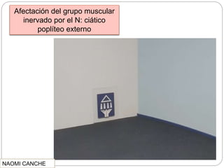 Afectación del grupo muscular
inervado por el N: ciático
poplíteo externo
NAOMI CANCHE
 