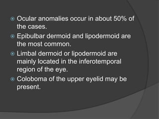  Ocular anomalies occur in about 50% of
the cases.
 Epibulbar dermoid and lipodermoid are
the most common.
 Limbal dermoid or lipodermoid are
mainly located in the inferotemporal
region of the eye.
 Coloboma of the upper eyelid may be
present.
 