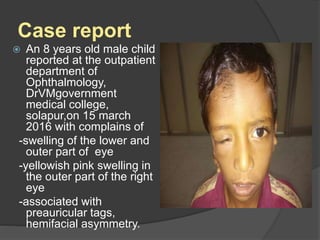 Case report
 An 8 years old male child
reported at the outpatient
department of
Ophthalmology,
DrVMgovernment
medical college,
solapur,on 15 march
2016 with complains of
-swelling of the lower and
outer part of eye
-yellowish pink swelling in
the outer part of the right
eye
-associated with
preauricular tags,
hemifacial asymmetry.
 