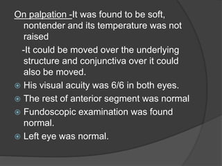 On palpation -It was found to be soft,
nontender and its temperature was not
raised
-It could be moved over the underlying
structure and conjunctiva over it could
also be moved.
 His visual acuity was 6/6 in both eyes.
 The rest of anterior segment was normal
 Fundoscopic examination was found
normal.
 Left eye was normal.
 