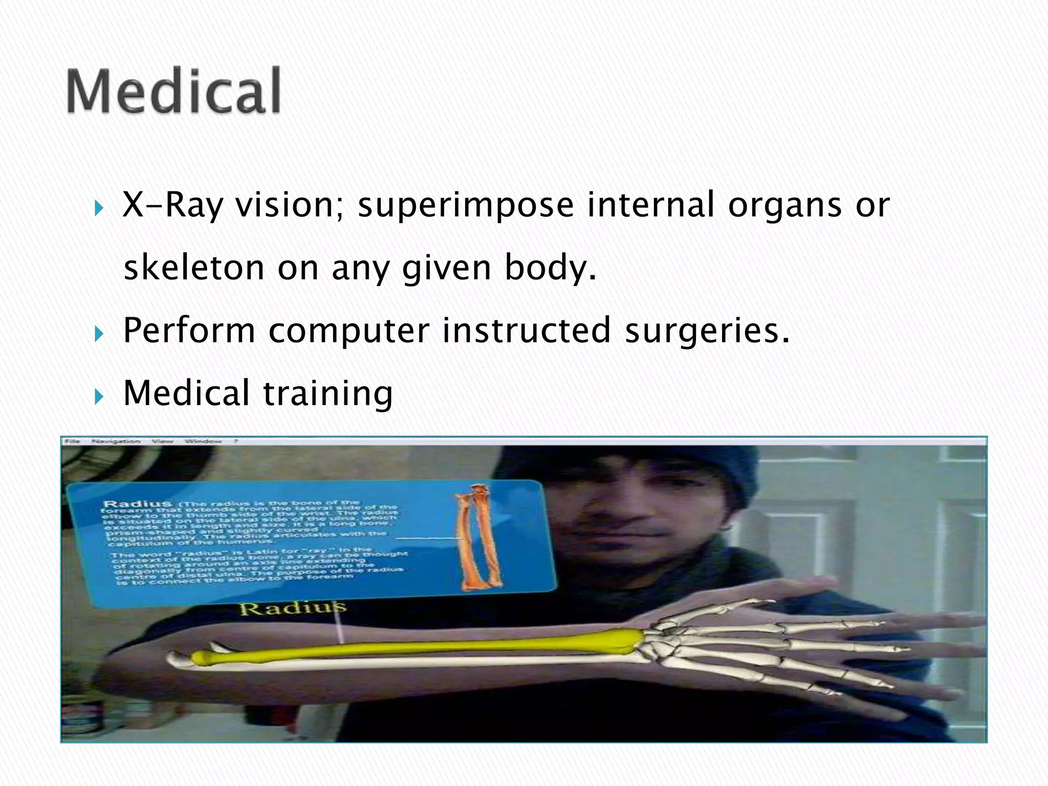 X-Ray vision; superimpose internal organs or
skeleton on any given body.
 Perform computer instructed surgeries.
 Medical training
 