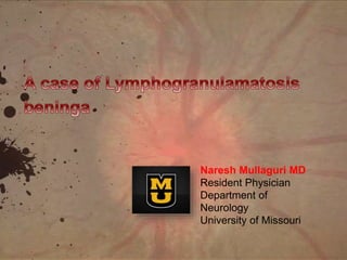 Naresh Mullaguri MD
Resident Physician
Department of
Neurology
University of Missouri
 