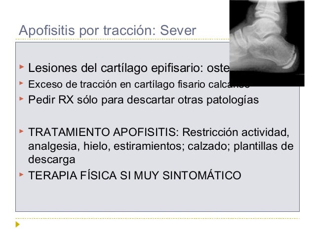 Duele en el esternón es pesado respirar da en medio en la espalda