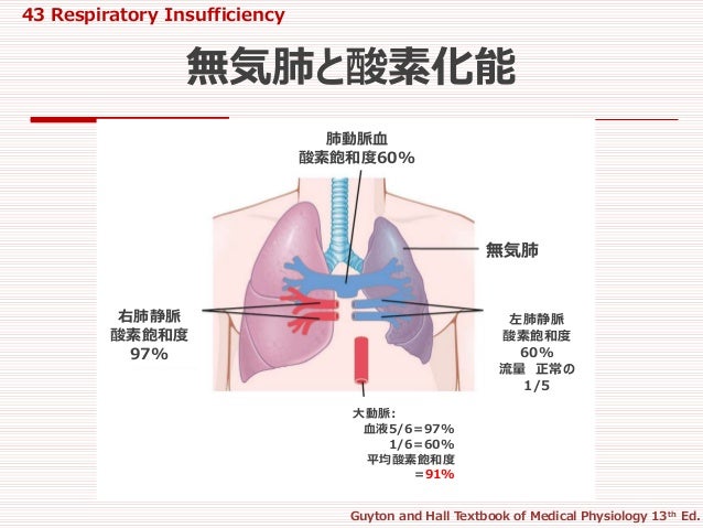 43 Respiratory Insufficiency