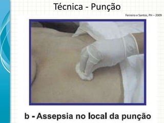 Técnica - Punção
                   Ferreira e Santos, PH – 2009
 