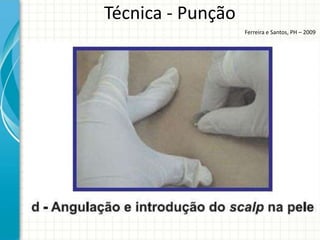 Técnica - Punção
                   Ferreira e Santos, PH – 2009
 