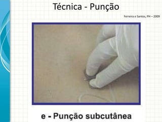 Técnica - Punção
                   Ferreira e Santos, PH – 2009
 