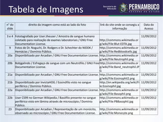 Tabela de Imagens
n° do
slide
direito da imagem como está ao lado da foto link do site onde se consegiu a
informação
Data do
Acesso
3 e 4 Fototagrafado por User:Jheuser / Amostra de sangue humano
coletado para realização de exames laboratoriais / GNU Free
Documentation License.
http://commons.wikimedia.or
g/wiki/File:Blut-EDTA.jpg
11/09/2012
9 Fotos de Dr. Noguchi, Dr. Rodgers e Dr. Schechter do NIDDK /
Hemácias / Domínio Público.
http://commons.wikimedia.or
g/wiki/File:Redbloodcells.jpg
11/09/2012
20a Disponibilizado por Arcadian / GNU Free Documentation License. http://commons.wikimedia.or
g/wiki/File:Neutrophil.png
11/09/2012
20b Bobjgalindo / Esfregaço de sangue com um Neutrófilo / GNU Free
Documentation License.
http://commons.wikimedia.or
g/wiki/File:Band_neutrophil.JP
G
11/09/2012
21a Disponibilizado por Arcadian / GNU Free Documentation License. http://commons.wikimedia.or
g/wiki/File:Eosinophil2.png
11/09/2012
21b Disponibilizado por InvictaHOG / Eosinófilo visto no sangue
periférico / Domínio Público.
http://en.wikipedia.org/wiki/Fi
le:Eosinophil.jpg
11/09/2012
22a Disponibilizado por Arcadian / GNU Free Documentation License. http://commons.wikimedia.or
g/wiki/File:Basophil.png
11/09/2012
22b User CS99 no German Wikipedia / Basófilo presente no sangue
periférico visto em lâmina através de microscópio / Domínio
Público.
http://commons.wikimedia.or
g/wiki/File:PBBasophil.jpg
11/09/2012
23 Disponibilizado por Arcadian / Representação de um monócito,
observado ao microscópio / GNU Free Documentation License.
http://commons.wikimedia.or
g/wiki/File:Monocyte.png
11/09/2012
 
