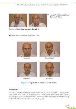37
TRASTORNOS DEL HABLA Y VOZ EN LOS AFECTADOS DE PARKINSON
Figura 16. Estimulación táctil: Masajes.
Pellizcar las diferentes zonas de la cara.
Figura 17. Expresión de emociones con la cara.
La postura
Los trastornos posturales que presentan los Afectados de Parkinson incrementan las
dificultades en la fonación. Se trabajará para conseguir un eje corporal vertical y una
postura que favorezca los movimientos de los músculos implicados en la respiración y
así facilitar la fonación (Figuras 18, 19, 20, 21 y 22).
Masaje facial con cepillo de
dientes eléctrico.
☛
Aburrido
Contento
Sorprendido
Enfadado
☛
 