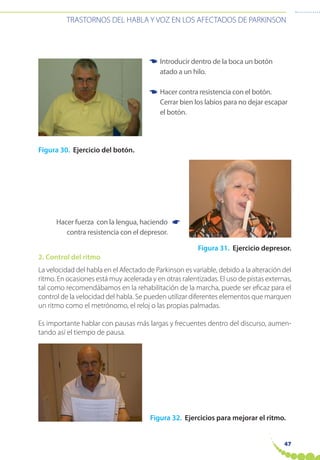 47
TRASTORNOS DEL HABLA Y VOZ EN LOS AFECTADOS DE PARKINSON
Figura 30. Ejercicio del botón.
Figura 31. Ejercicio depresor.
2. Control del ritmo
La velocidad del habla en el Afectado de Parkinson es variable, debido a la alteración del
ritmo. En ocasiones está muy acelerada y en otras ralentizadas. El uso de pistas externas,
tal como recomendábamos en la rehabilitación de la marcha, puede ser eficaz para el
control de la velocidad del habla. Se pueden utilizar diferentes elementos que marquen
un ritmo como el metrónomo, el reloj o las propias palmadas.
Es importante hablar con pausas más largas y frecuentes dentro del discurso, aumen-
tando así el tiempo de pausa.
Figura 32. Ejercicios para mejorar el ritmo.
Introducir dentro de la boca un botón
atado a un hilo.
Hacer contra resistencia con el botón.
Cerrar bien los labios para no dejar escapar
el botón.
☛
☛
☛
Hacer fuerza con la lengua, haciendo
contra resistencia con el depresor.
 