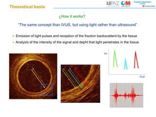 “The same concept than IVUS, but using light rather than ultrasound”
 Emission of light pulses and reception of the fraction backscatterd by the tissue
 Analysis of the intensity of the signal and depht that light penetrates in the tissue
Int
Prof
¿How it works?
Theoretical basis
 