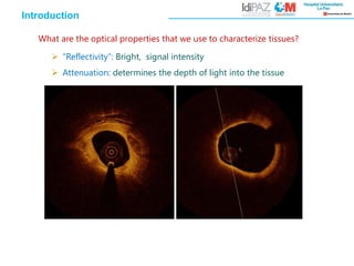 Introduction
What are the optical properties that we use to characterize tissues?
 “Reflectivity”: Bright, signal intensity
 Attenuation: determines the depth of light into the tissue
 