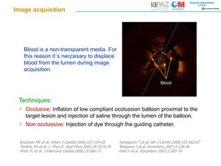 Image acquisition
Blood is a non-transparent media. For
this reason it´s neccesary to displace
blood from the lumen during image
acquisition.
Techniques:
 Occlusive: Inflation of low compliant occlussion balloon proximal to the
target lesion and injection of saline through the lumen of the balloon.
 Non occlussive: Injection of dye through the guiding catheter.
Brezinski ME et al. Intern J Cardiol 2006;107:154-65
Tomlins PH et al. J. Phys D: Appl Phys 2005;38:2519-35
Pinto TL et al. J Intervent Cardiol 2006;19:566-73
Yamaguchi T et al. Am J Cardiol 2008;101:562-67
Tanigawa J et al. Eurointerv 2007;3:128-36
Prati F et al. Eurointerv 2007;3:365-70
Blood
 
