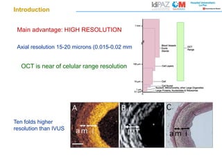Axial resolution 15-20 microns (0.015-0.02 mm)
Main advantage: HIGH RESOLUTION
Introduction
OCT is near of celular range resolution
Ten folds higher
resolution than IVUS
 