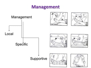 Management
Management
Local
Specific
Supportive
 