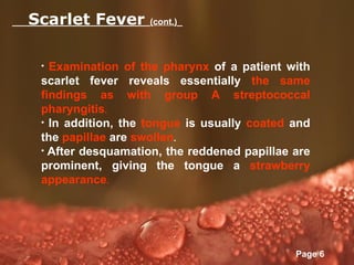 Scarlet Fever | PPT