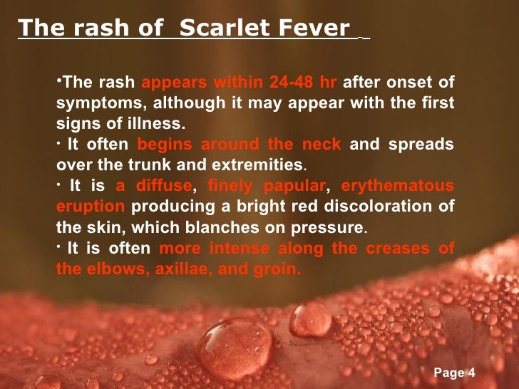 Scarlet Fever Rash, Symptoms, Treatment & Pictures