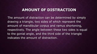 445629097-distraction-osteogenesis-pptx.pptx