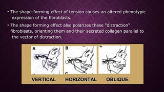 445629097-distraction-osteogenesis-pptx.pptx